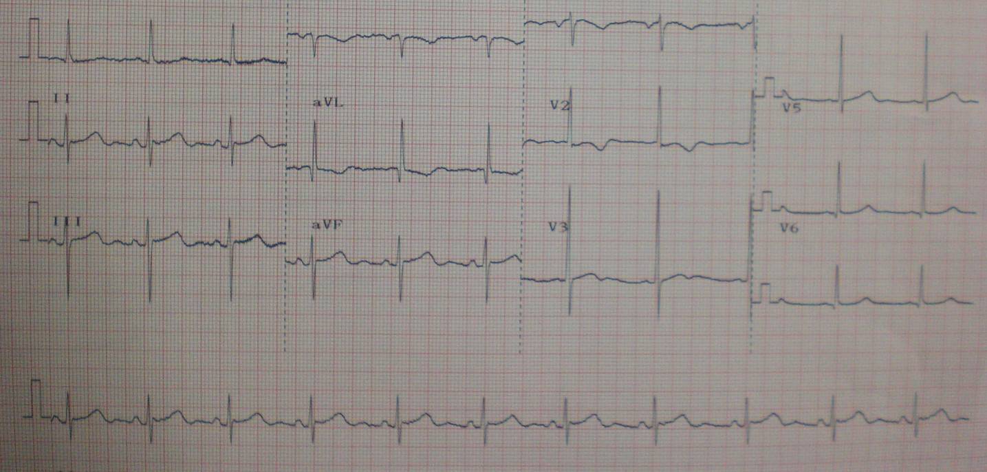 [EKG+19-2-53.jpg]