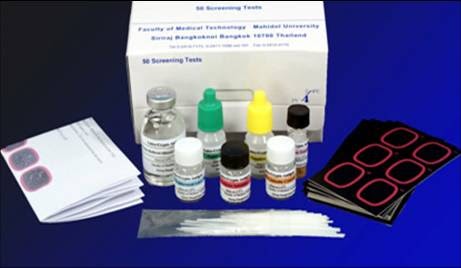 cryptococcal antigen meningitis 