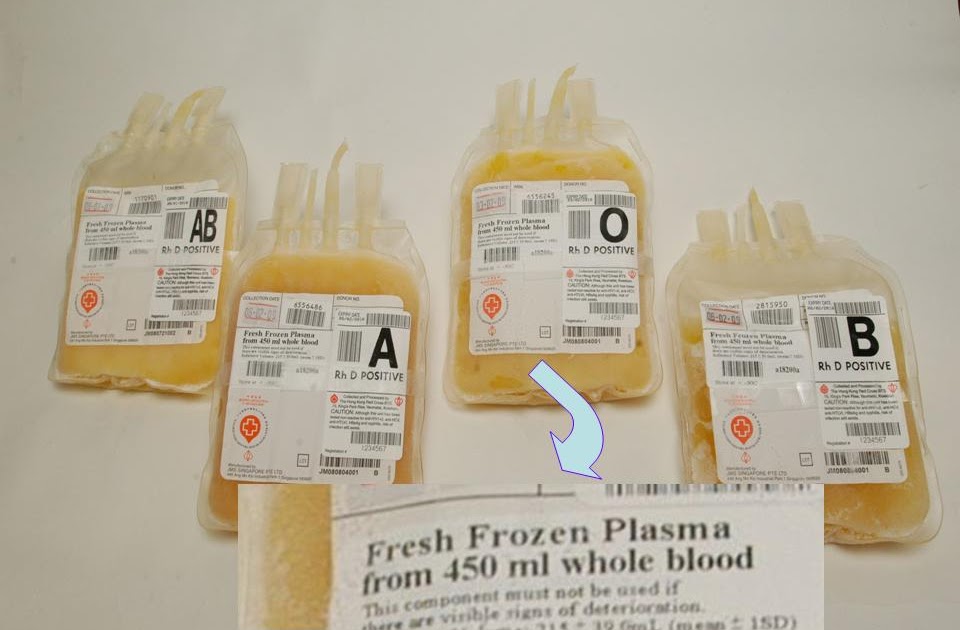 Phimaimedicine 197. Fresh frozen plasma transfusion