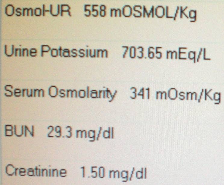 TTKG Calculator Transtubular Potassium Gradient, 53 OFF