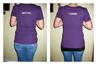 non invasive tummy tuck near me non invasive tummy tuck near me