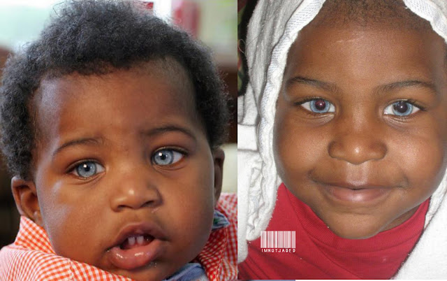 Black People With Blue Eyes Natural Phenomenon Or Genetic Mutation