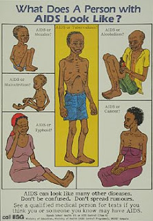 fitness of health what happens if im hiv positive swollen lymph nodes hiv