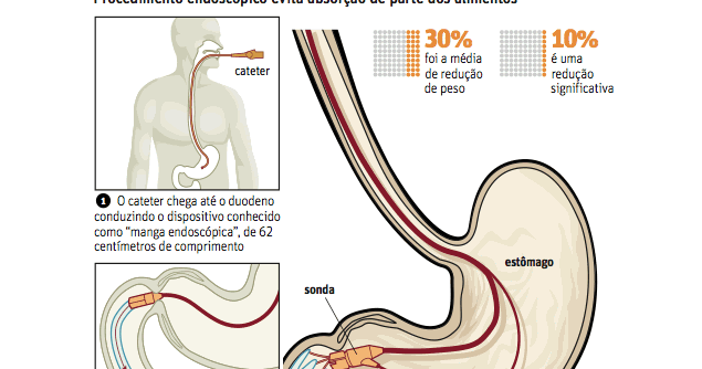 O tempero deixou de fumar respostas