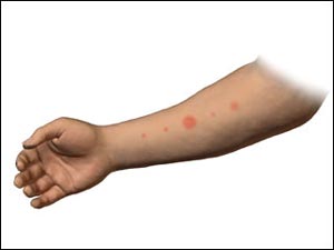 [allergy3.jpg]