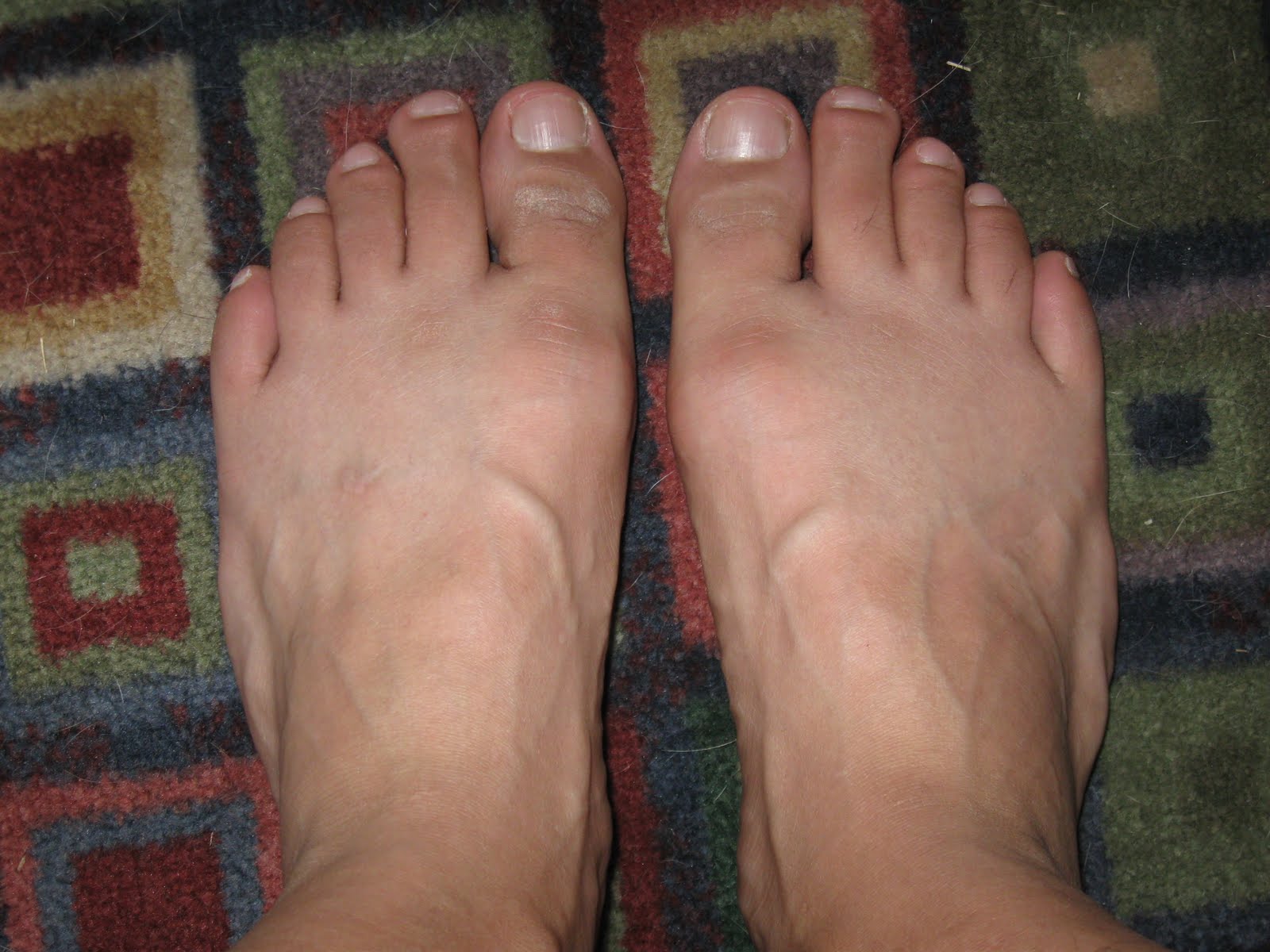 Mature feet and toes