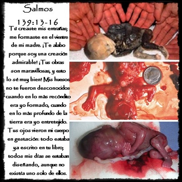 INFORMACION DEL ABORTO informacion del aborto:
