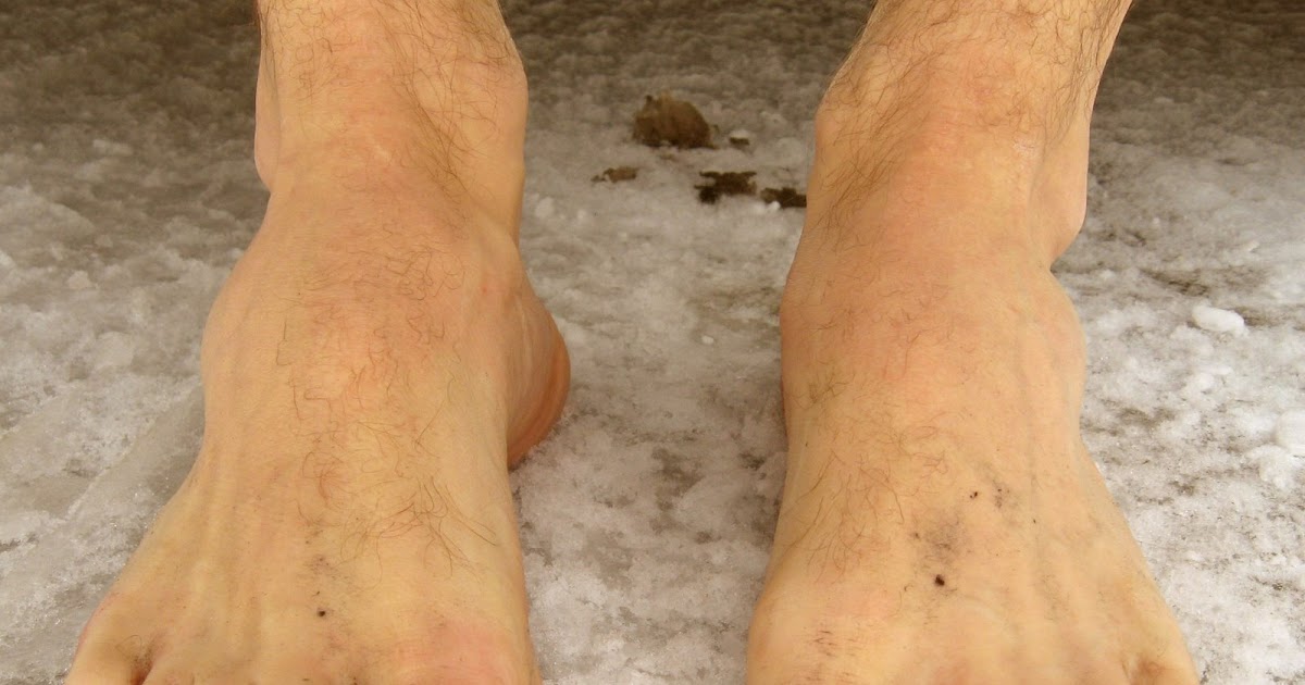 gIANt Running Grossest Feet?