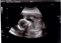 Baby's Third Scan - 20+5