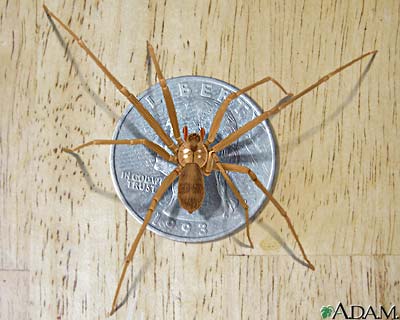 house spider bites pictures. spider bite brown recluse spider bite. house spider bites pictures.