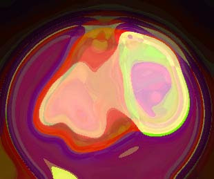 Bild