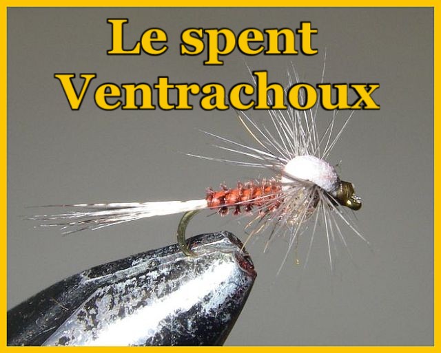 [ventrachoux.jpg]