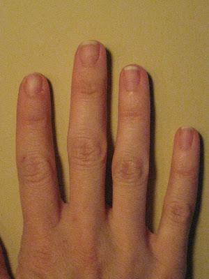 Check out my before and after pics of my hands with and without the nails
