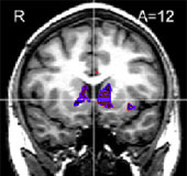 [brainscanA.jpg]
