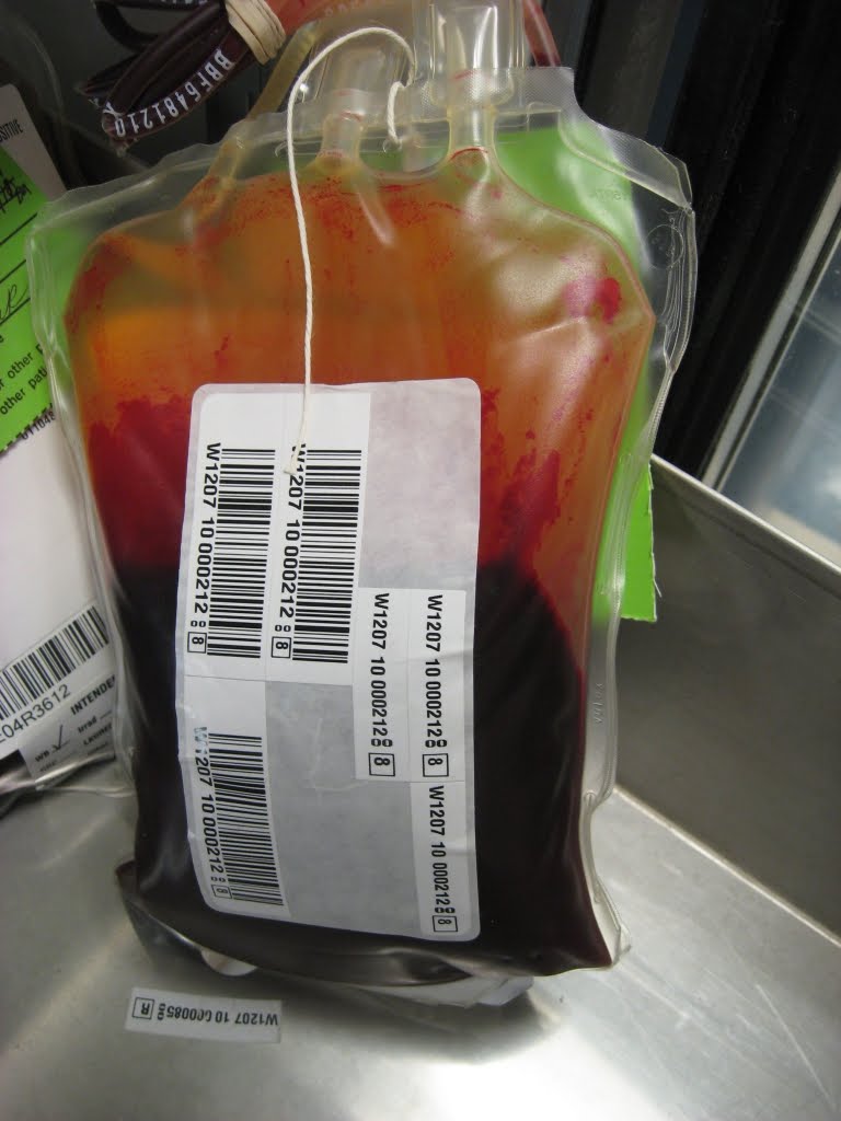 Antijenic Drift Blood Bank Expiration Dates (Red Cells)