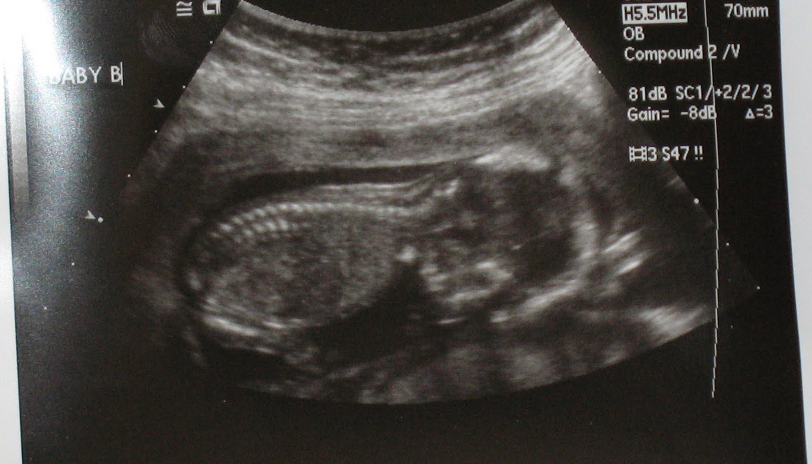 The Moon Family Baby Update