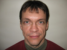 3/4/08 - Five Months After Surgery