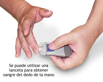 Los defectos de las uñas la causa y el tratamiento