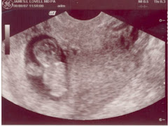 Grant's First Pic