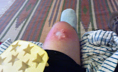 Attempting to massage my knee with an ice cube was messier than I imagined!