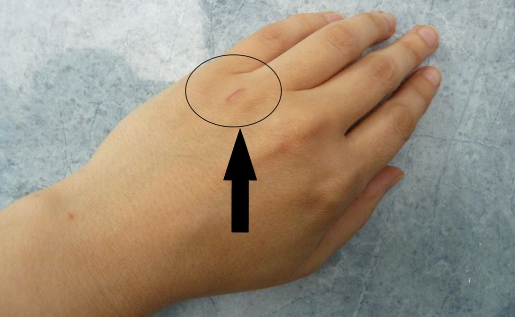 Gaby Trails My first machete wound!