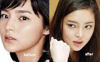 nose park shiyeon c1 model nose park shiyeon c1 Gadis Cantik Hot