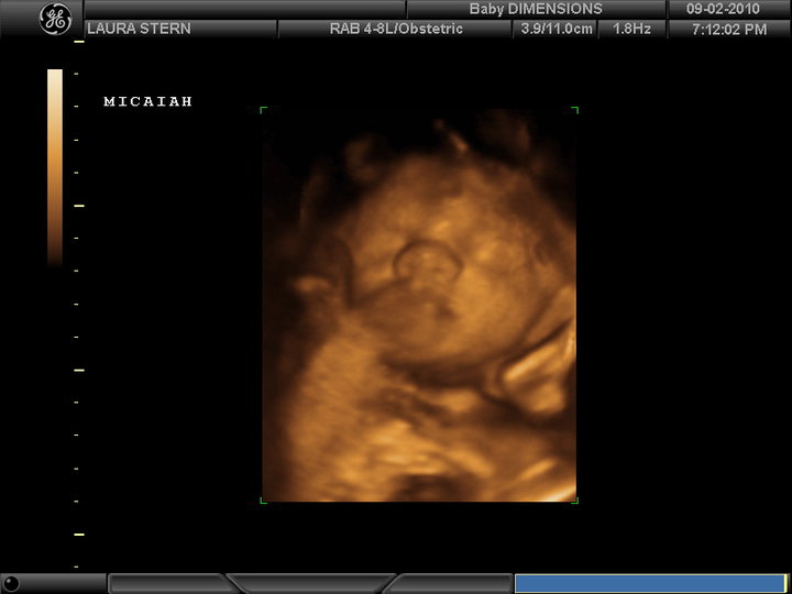Black Baby Ultrasound