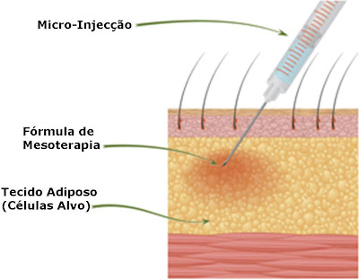 Tutano vegetal conteúdo calórico de uns carboidratos de gorduras de esquilo