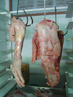 Verge of Existence: Human Body Parts for Sale
