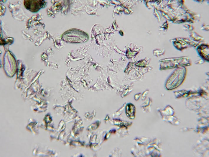 Enterobius Vermicularis