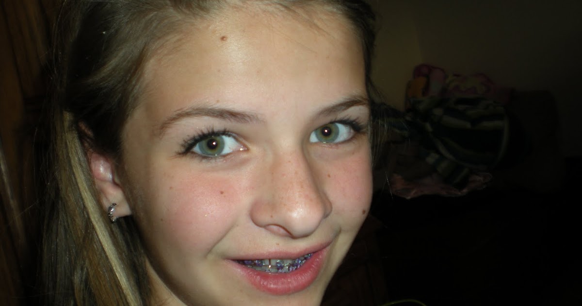 Eight is Great BRACES!! )