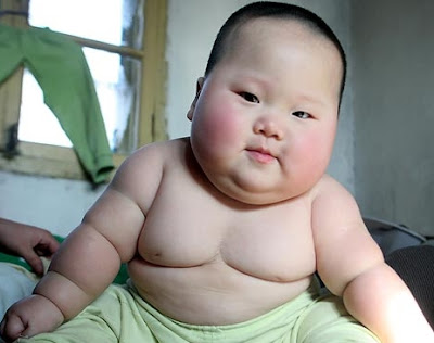Obese Baby Obese Baby