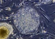 Stem cells Stem cells