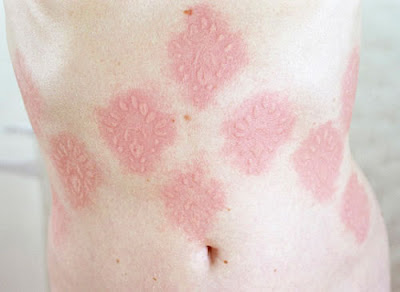 Skin art Skin art