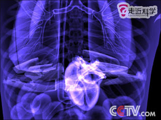 Heart located at abdominal area Heart located at abdominal area