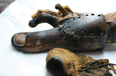 The Cairo toe The Cairo toe