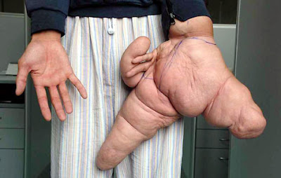 Large hand Liu Hua with a larger hand
