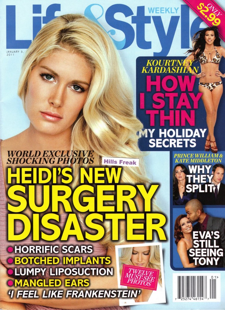 heidi montag after surgery people. year after Heidi famously