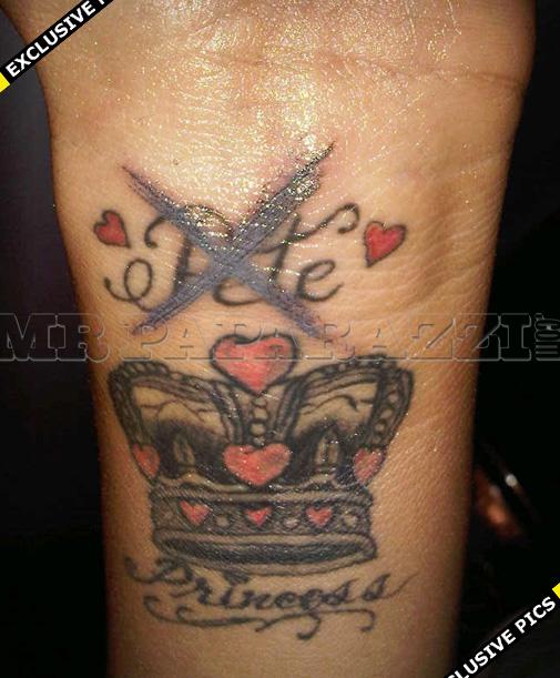 Tattoo Work of art Or an inked scar