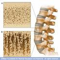 மாதவிடாய் நிற்றல்.! Osteoporsis+1