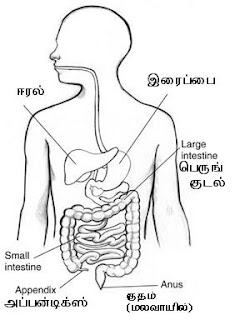 அப்பன்டிசைடிஸ் (Appendicitis)- கல் அடைப்பது அல்ல Appendix+Tamil