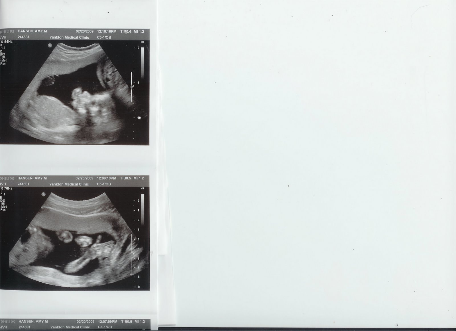 [ultrasound+pictures.jpg]