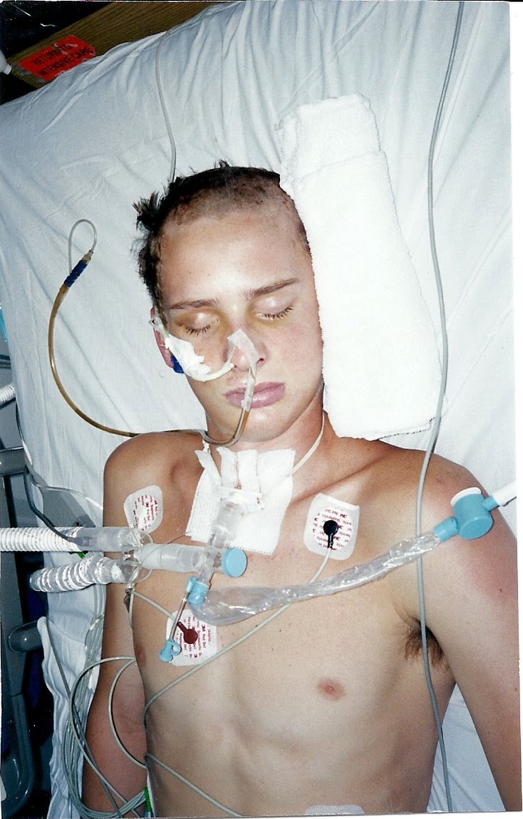 Kendall Neuner Hot Brad's accident pictures.