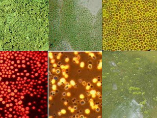 Cyanobacteria, many forms, Anabva, Microcy, bloom