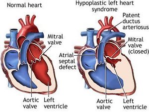 Fetus Heart Diagram