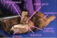 Sheep+brain+dissection+worksheet