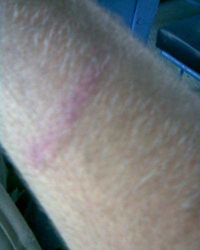 [myhand.jpg]