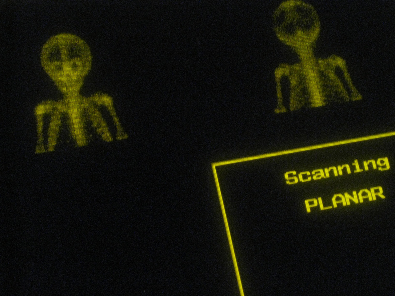 [Leukemia-Bone-Scan-Skeleton.jpg]
