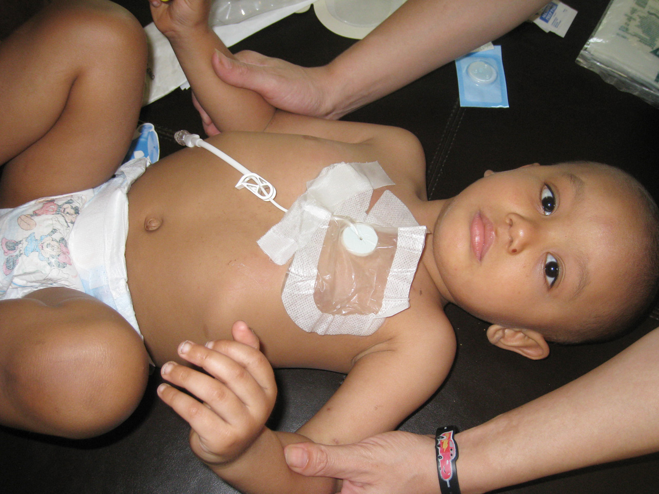 [Leukemia-Dressing-Change-1.jpg]