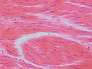 Establecen la relación entre el estrés oxidativo y la Establecen la relación entre el estrés oxidativo y la